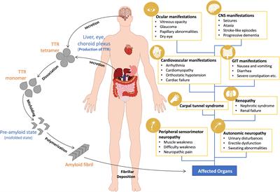 Contributions of Animal Models to the Mechanisms and Therapies of Transthyretin Amyloidosis